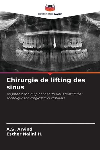Cover image for Chirurgie de lifting des sinus