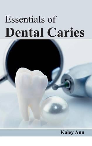 Cover image for Essentials of Dental Caries
