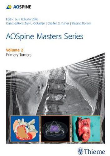 Cover image for AOSpine Masters Series Volume 2: Primary Spinal Tumors