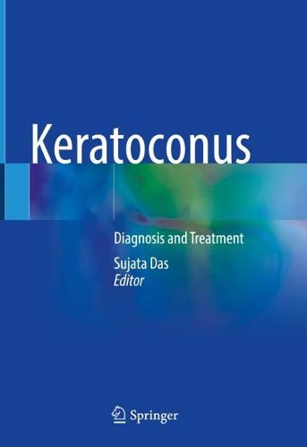 Cover image for Keratoconus: Diagnosis and Treatment