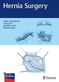 Cover image for Hernia Surgery