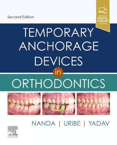 Cover image for Temporary Anchorage Devices in Orthodontics