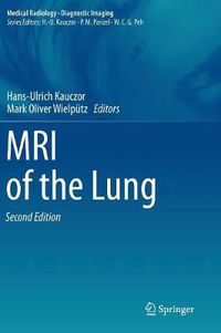 Cover image for MRI of the Lung