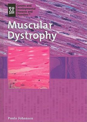 Muscular Dystrophy