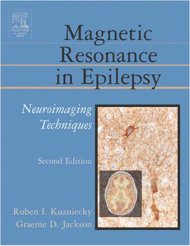 Cover image for Magnetic Resonance in Epilepsy: Neuroimaging Techniques, Second Edition