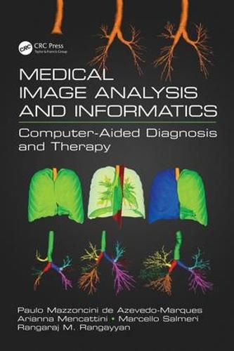 Cover image for Medical Image Analysis and Informatics: Computer-Aided Diagnosis and Therapy: Computer-Aided Diagnosis and Therapy