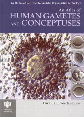 Cover image for An Atlas of Human Gametes and Conceptuses: An Illustrated Reference for Assisted Reproductive Technology