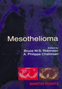 Cover image for Mesothelioma