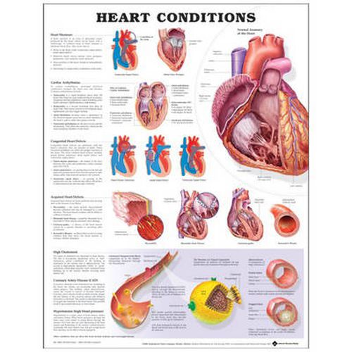 Cover image for Heart Conditions