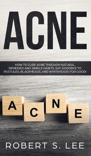 Acne: How to Cure Acne through Natural Remedies and Simple Habits. Say Goodbye to Pustules, Blackheads and Whiteheads for Good!