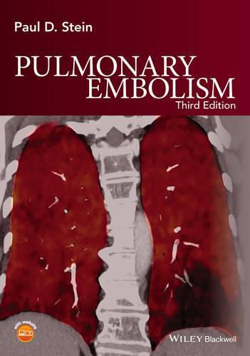 Cover image for Pulmonary Embolism