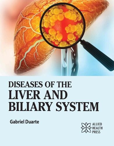 Cover image for Diseases of the Liver and Biliary System