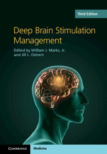 Cover image for Deep Brain Stimulation Management