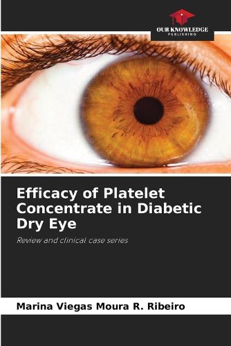 Cover image for Efficacy of Platelet Concentrate in Diabetic Dry Eye