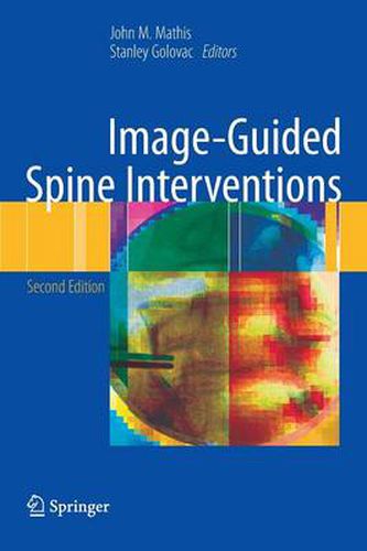 Cover image for Image-Guided Spine Interventions