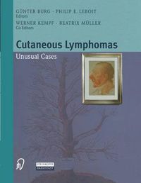 Cover image for Cutaneous Lymphomas: Unusual Cases