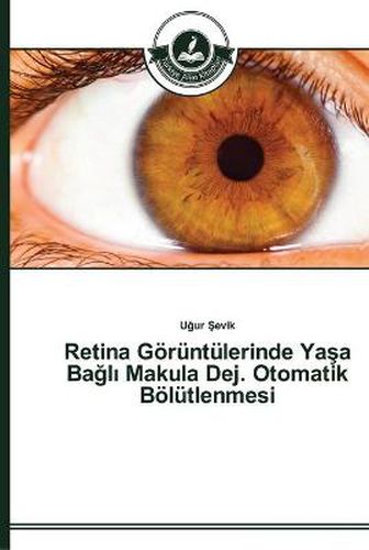 Retina Goeruntulerinde Ya&#351;a Ba&#287;l&#305; Makula Dej. Otomatik Boelutlenmesi