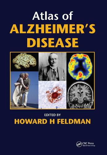 Cover image for Atlas of Alzheimer's Disease