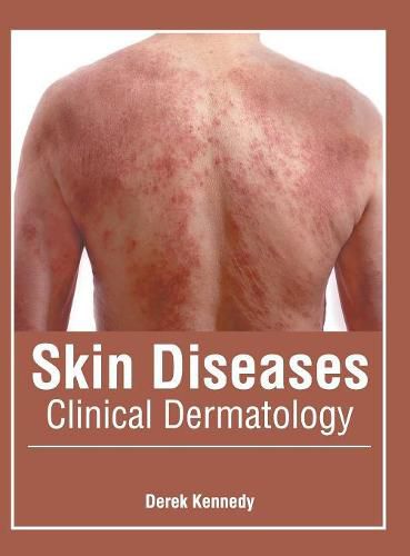 Cover image for Skin Diseases: Clinical Dermatology