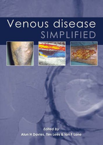 Cover image for Venous Disease Simplified