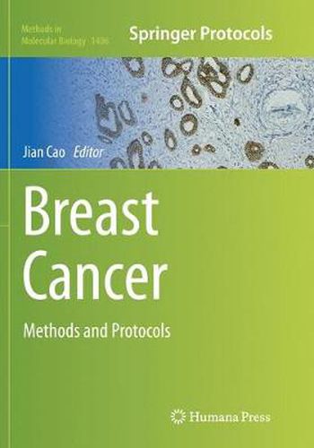 Cover image for Breast Cancer: Methods and Protocols