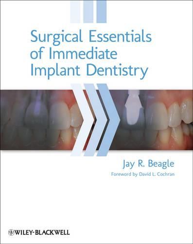 Cover image for Surgical Essentials of Immediate Implant Dentistry