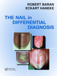 Cover image for Nail in Differential Diagnosis