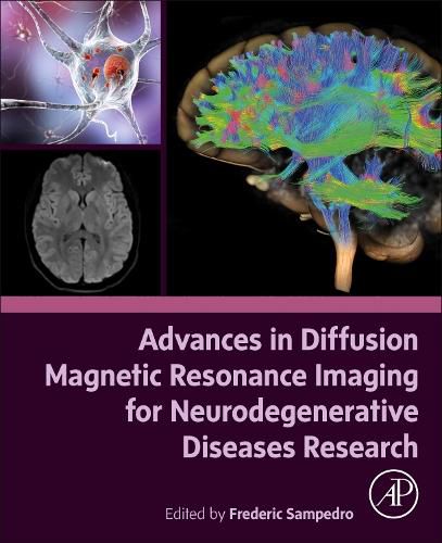 Cover image for Advances in Diffusion Magnetic Resonance Imaging for Neurodegenerative Diseases Research