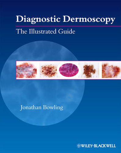 Cover image for Diagnostic Dermoscopy: The Illustrated Guide