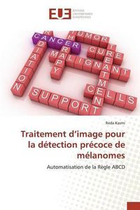 Cover image for Traitement D Image Pour La Detection Precoce de Melanomes