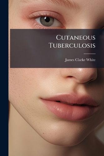 Cover image for Cutaneous Tuberculosis: Its Clinical Aspects and Etiological Relations