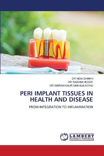 Peri Implant Tissues in Health and Disease, Dr Nida Shaikh, Dr Rashmi ...