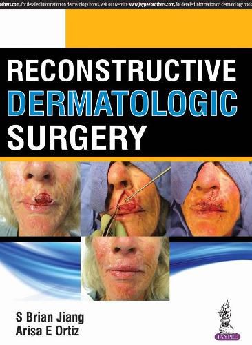 Cover image for Reconstructive Dermatologic Surgery