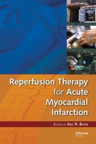 Cover image for Reperfusion Therapy for Acute Myocardial Infarction
