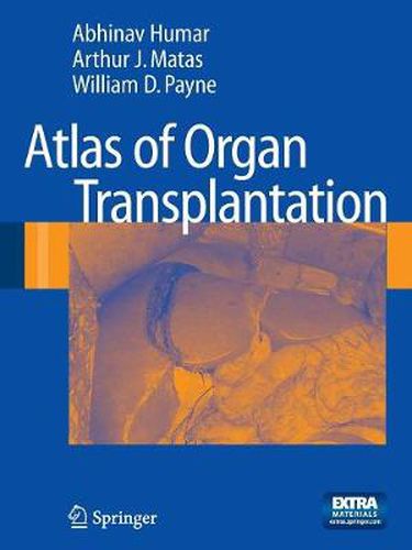 Cover image for Atlas of Organ Transplantation