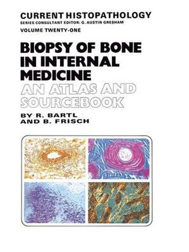 Cover image for Biopsy of Bone in Internal Medicine: An Atlas and Sourcebook