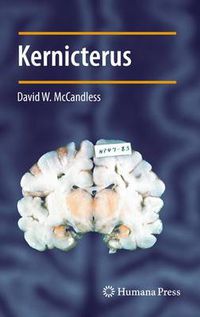 Cover image for Kernicterus
