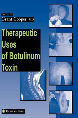 Cover image for Therapeutic Uses of Botulinum Toxin