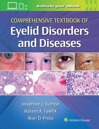 Cover image for Comprehensive Textbook of Eyelid Disorders and Diseases