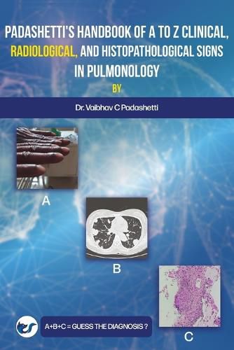 Cover image for Padashetti's Textbook on A to Z Signs in Pulmonology