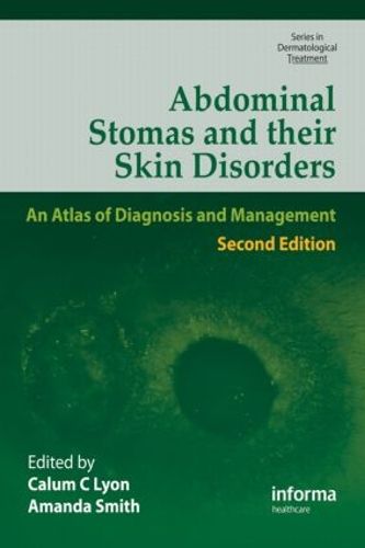 Cover image for Abdominal Stomas and Their Skin Disorders