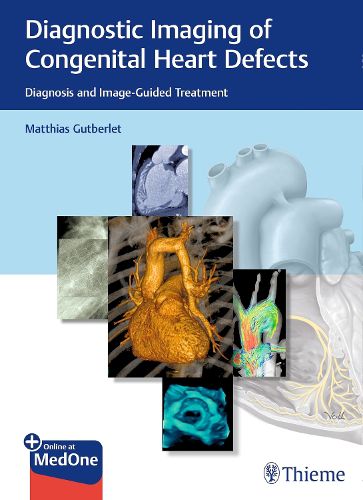 Cover image for Diagnostic Imaging of Congenital Heart Defects: Diagnosis and Image-Guided Treatment