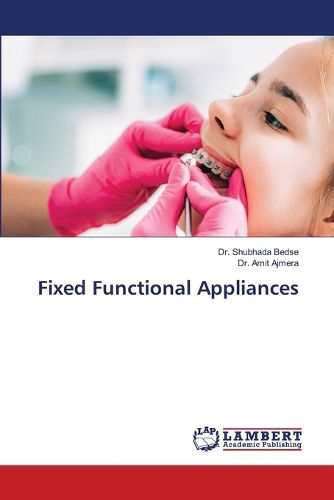 Cover image for Fixed Functional Appliances