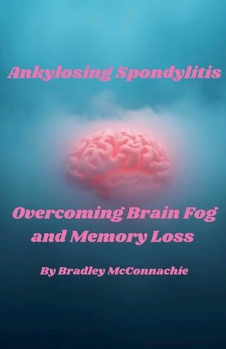 Cover image for Ankylosing Spondylitis Overcoming Brain Fog and Memory Loss