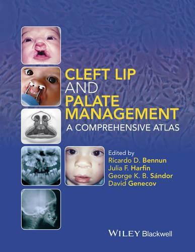 Cleft Lip and Palate Management - A Comprehensive Atlas