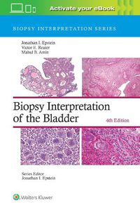 Cover image for Biopsy Interpretation of the Bladder