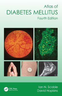 Cover image for Atlas of Diabetes Mellitus