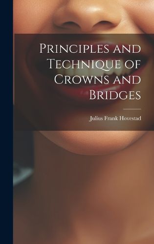 Cover image for Principles and Technique of Crowns and Bridges