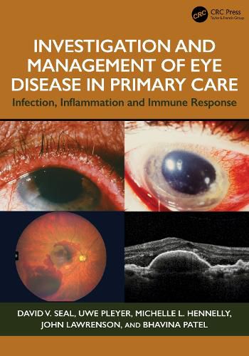 Cover image for Investigation & Management of Eye Disease in Primary Care