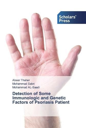 Cover image for Detection of Some Immunologic and Genetic Factors of Psoriasis Patient